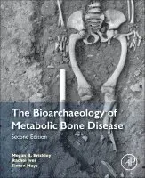 The Bioarchaeology of Metabolic Bone Disease