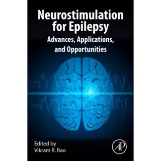Neurostimulation for Epilepsy