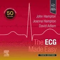 The ECG Made Easy