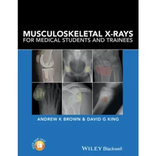 Musculoskeletal X-Rays for Medical Students and Trainees