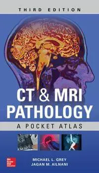 CT & MRI Pathology: A Pocket Atlas, Third Edition