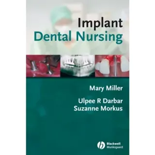Implant Dental Nursing