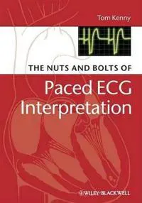 The Nuts and bolts of Paced ECG Interpretation