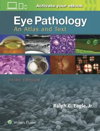 Eye Pathology