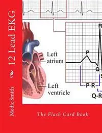 12 Lead EKG