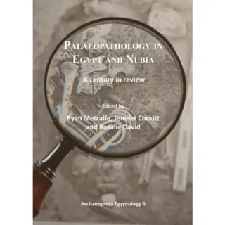 Palaeopathology in Egypt and Nubia