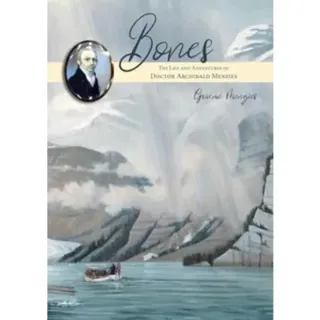Bones