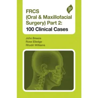 FRCS (Oral & Maxillofacial Surgery) Part 2: 100 Clinical Cases