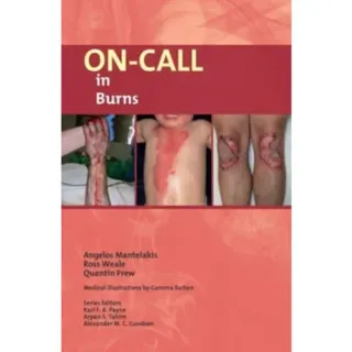 On-Call in Burns