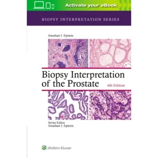 Biopsy Interpretation of the Prostate