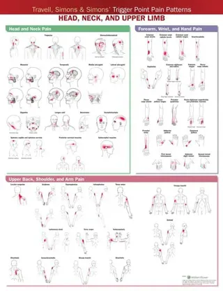 Travell, Simons & Simons’ Trigger Point Pain Patterns Wall Chart