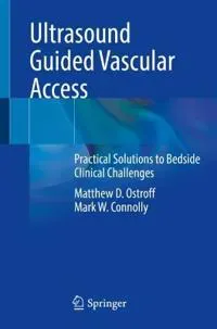 Ultrasound Guided Vascular Access