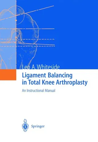 Ligament Balancing in Total Knee Arthroplasty