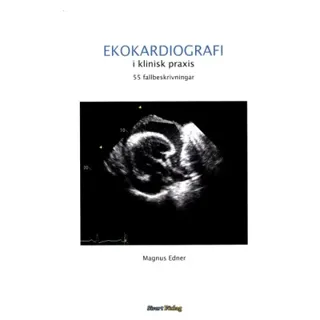Ekokardiografi i klinisk praxis: 55 fallbeskrivningar