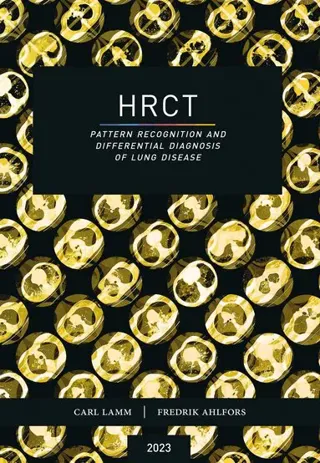 HRCT : pattern recognition and differential diagnosis of lung disease