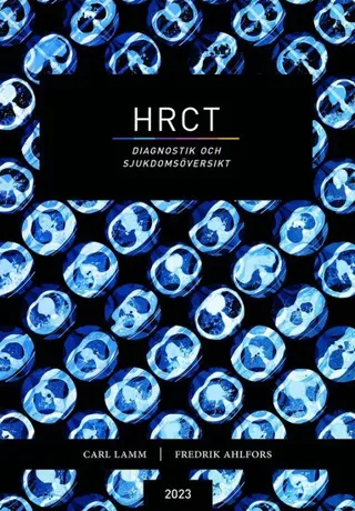 HRCT : diagnostik och sjukdomsöversikt