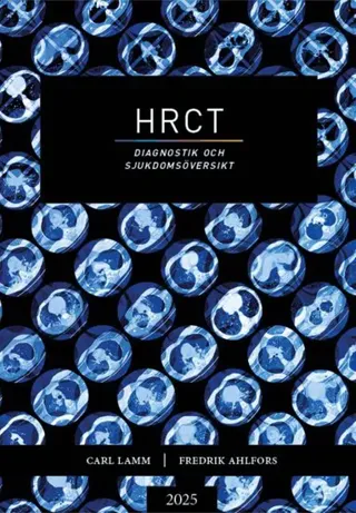 HRCT : diagnostik och sjukdomsöversikt