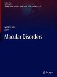 Macular Disorders