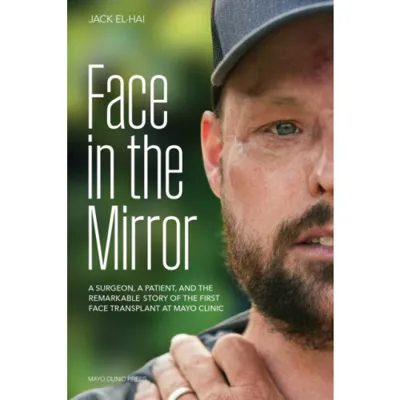 Face Transplant